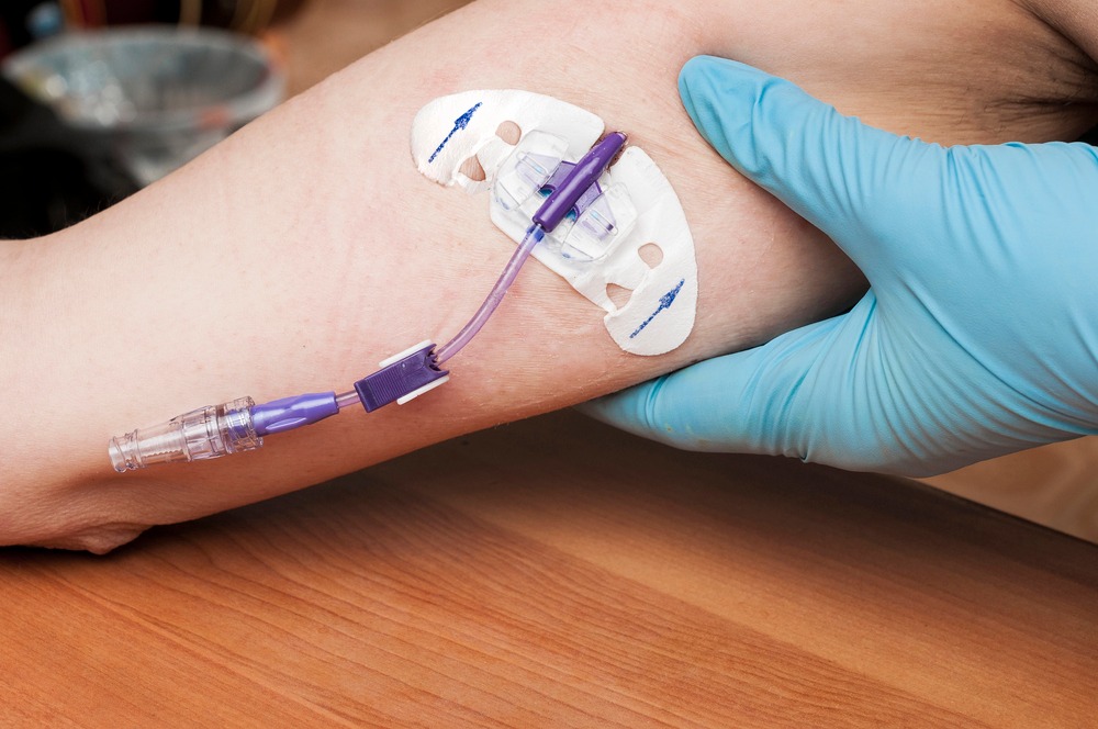 picc insertion
